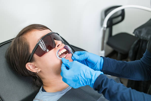 Best Teeth Whitening  in Irwin, SC
